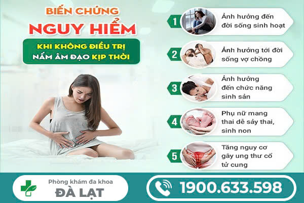 Hình ảnh minh họa